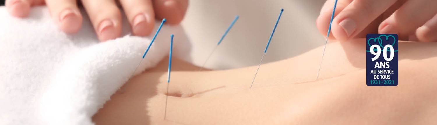 Acupuncture