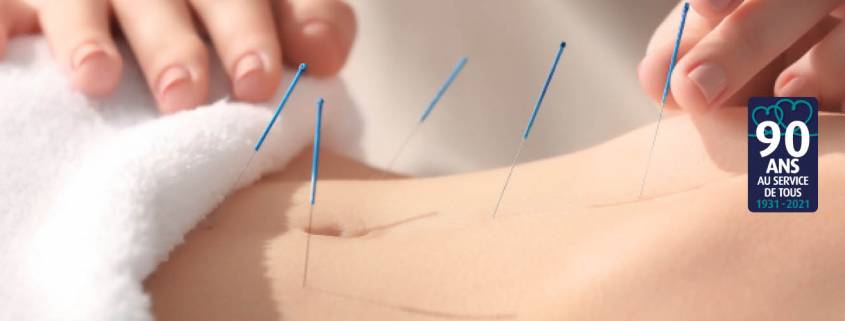 Acupuncture