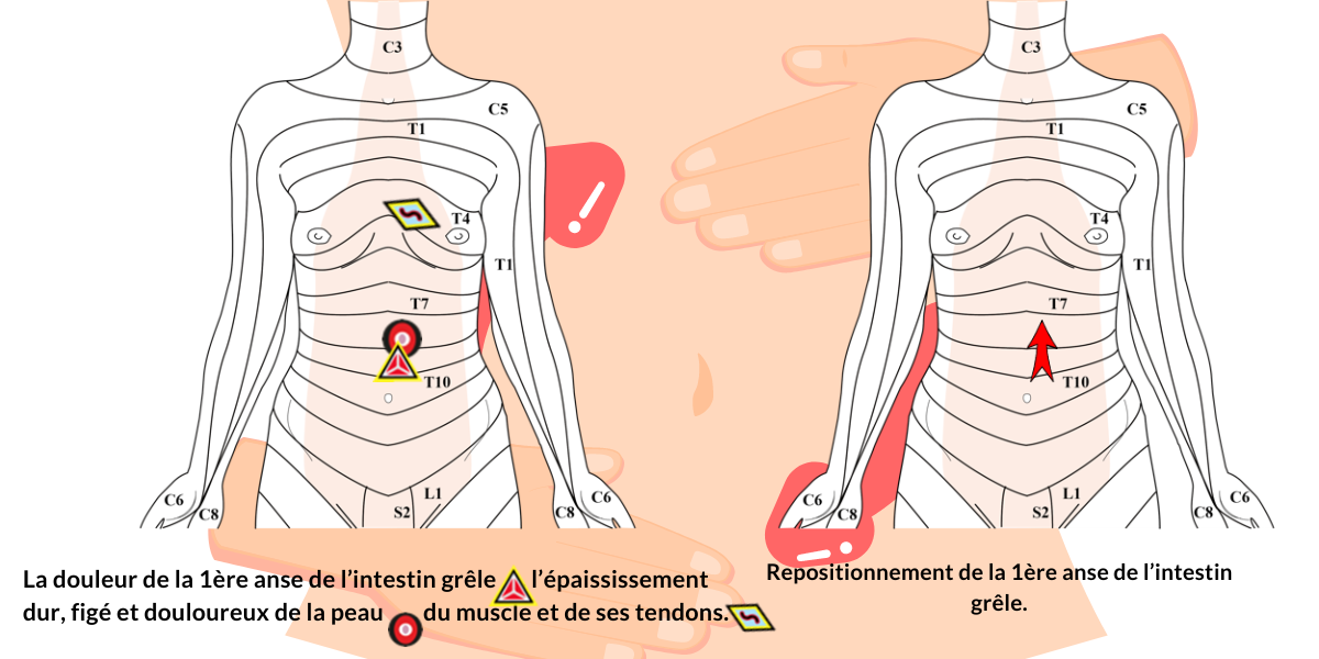 massage spécifique candidose digestive CMH
